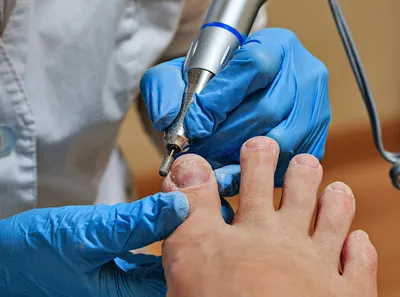 Vigipodia - Gabinet podologiczny i pedicure